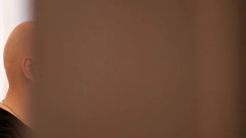 Bald man dreams of long thick hair on his head Stock Footage 75952652