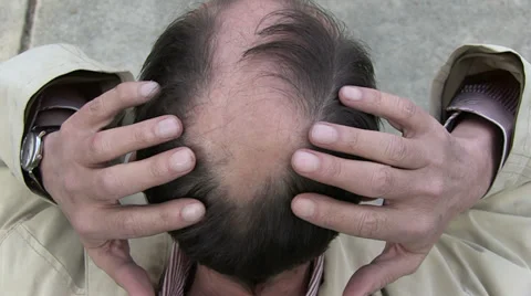 Bald man Stock Footage 36524605