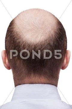 Bald man head Stock Photos