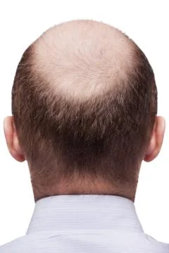 Bald man head Stock Photos