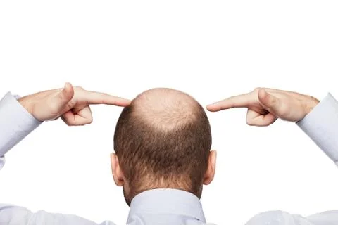 Bald man head Stock Photos