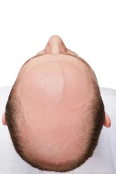 Bald man head Stock Photos