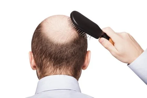 Bald man head Stock Photos