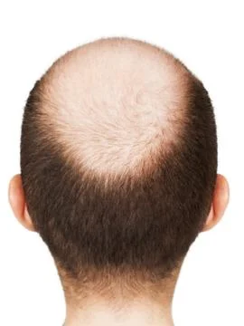 Bald men head Stock Photos