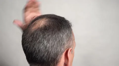 A balding, gray-haired older man is smoothing his hair on his head Stock Footage 189793141