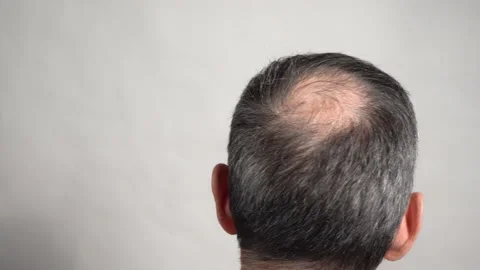 The balding head of a gray-haired man Stock Footage 191023435