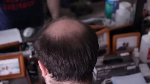 Balding Man Stock Footage 127944129