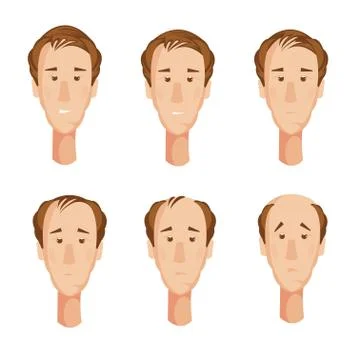 Balding Man Heads Set Stock Illustration