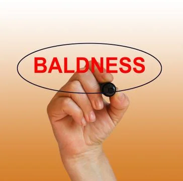 Baldness Stock Illustration