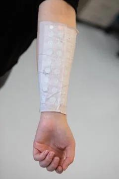Bandage on forearm Stock-Fotos