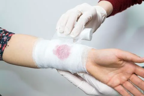 Bandage techniques Stock Photos