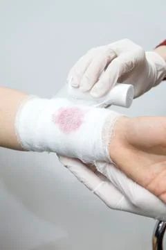 Bandage techniques Stock-Fotos