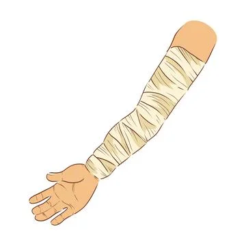 Bandaged hand in flat design. Broken human arm with bandage dressing. Vector  Stock Illustration