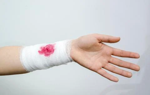 Bandaged wound 스톡 사진