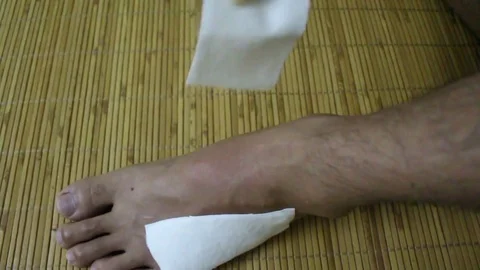 Bandages in the legs Stock Footage 78214646