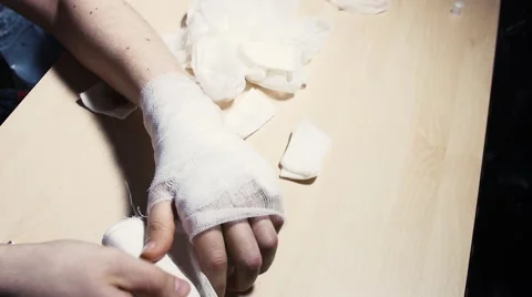 Bandaging broken arm 스톡 동영상 59977961