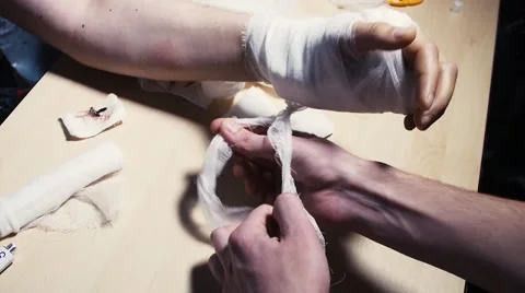 Bandaging broken arm 스톡 동영상 59977978