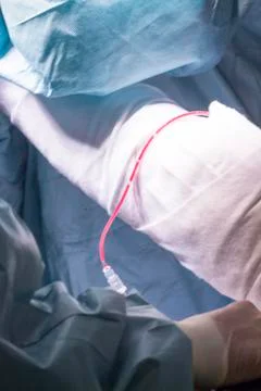 Bandaging post knee surgery Stock Photos