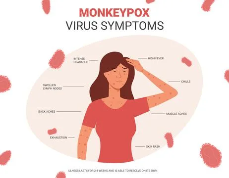 Banner with monkeypox virus symptoms Stock Illustration
