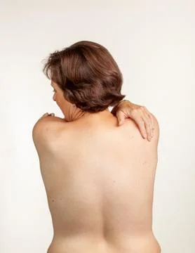 Bare back of overweight middle aged woman with moles and other skin irregular Foto stock