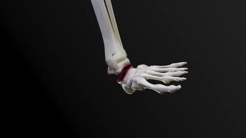 Bare bone fracture  4K Video stock 285108870
