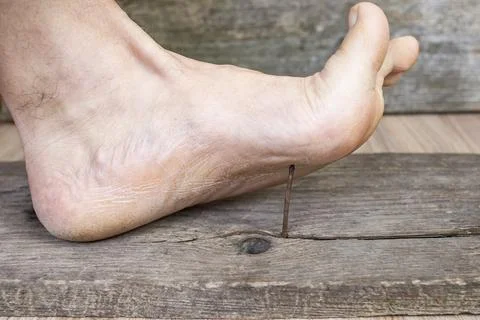 Bare foot stepping on a sharp rusty nail from a weathered wooden board, sof.. Stock Photos