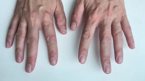 Bare hands with natural nails for dermatology and skincare concept Video stock 338186341