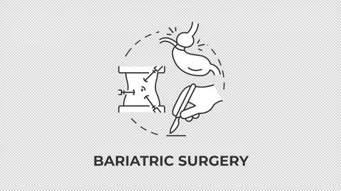 Bariatric surgery line concept icon animation Stock Footage 337774341