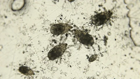 A barn or flour mite under a microscope Stock Footage 106934088