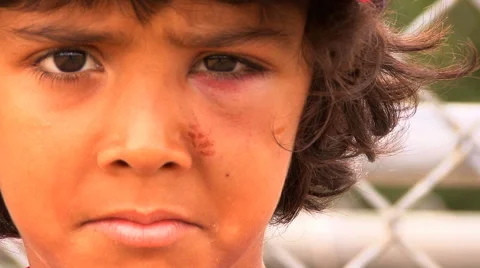 Baseball Gone Wrong HD Stock Footage 41171807