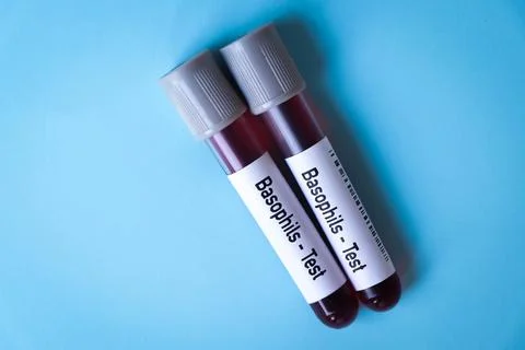 Basophils Test, blood sample to analyze in the laboratory Фото