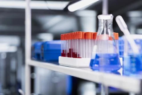 Batch of blood samples test tubes in empty lab ready to be analyzed Stock Photos