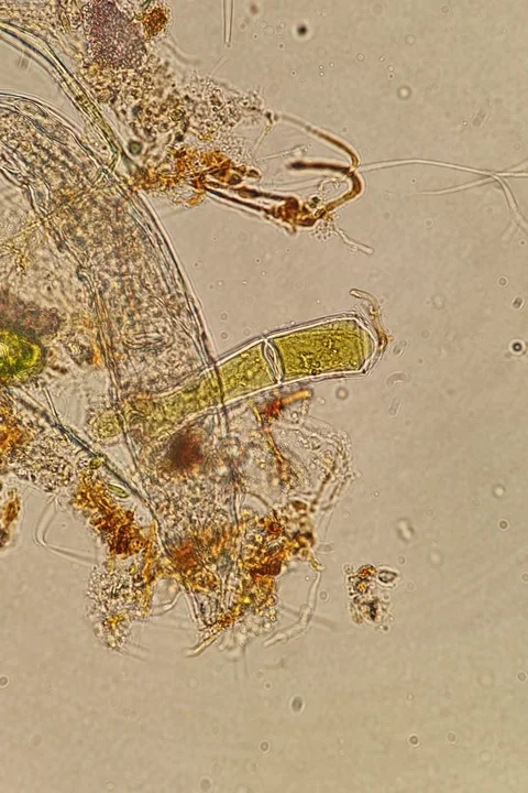 Bdelloid rotifer feeding among algae under light microscopy Video stock 333495689