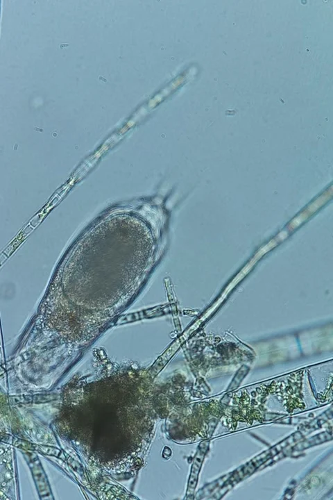 Bdelloid Rotifer Under Brightfield Microscopy, Microscopic Video Stock Footage 334339168