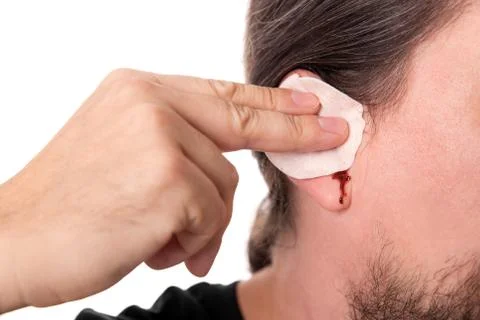 Bearded man having ear bleeding, isolated on white, concept otitis media 写真素材