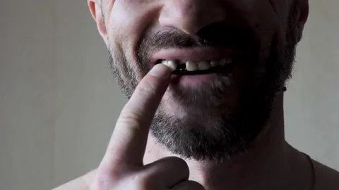 A bearded man shows off one tooth missing from the front of his mouth Stock Footage 280291034