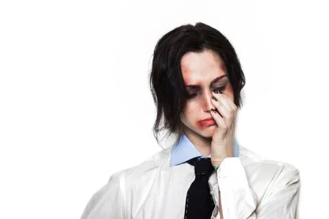 Beaten up girl crying Stock Photos
