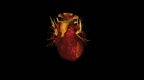 Heart Ct Scan Stock Footage ~ Royalty Free Stock Videos | Pond5