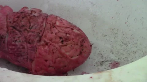 Beating human heart on the sink Stock Footage 46113484