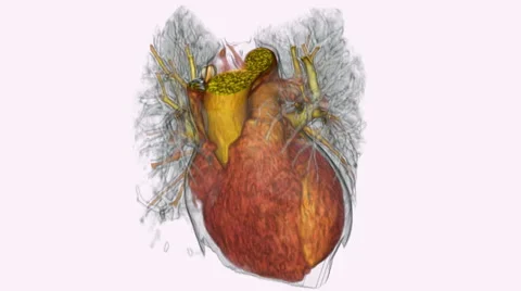 Ct Scan Heart Stock Footage ~ Royalty Free Stock Videos | Pond5