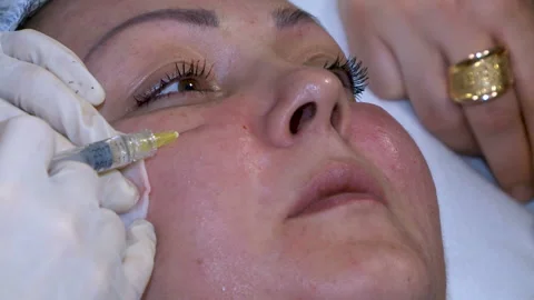 Beautician hands in gloves making face aging injection in a female skin. Video stock 90790053