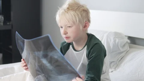 A beautiful blond boy is studying a picture of his lungs in the hospital. Stock Footage 129255990