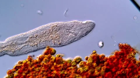 Beautiful Flatworm Microscopic Observation in 4K 库存影片 317210860