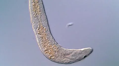 Beautiful Microscopic Flatworm with Dynamic Movements 스톡 동영상 317210992