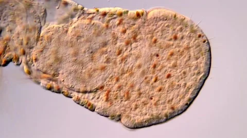 Beautiful Microscopic Worms — Aeolosoma Under the Lens Stock-Footage 317926832