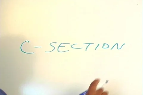 Beautiful Nurse Writes "C-Section" on a White Board (close-up) Stockbeeldmateriaal 522356