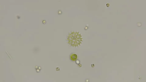 Beautiful pattern of diatom algae under a microscope Stock Footage 89569134
