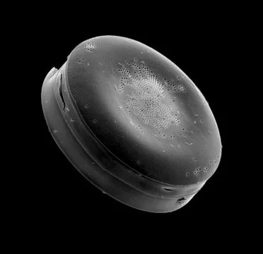 Beautiful single-celled organism smaller than a sand grain Foto stock
