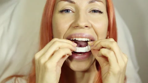 Beautiful Smiling girl Holding Retainer for Teeth (Dental Braces) Stock Footage 59643898