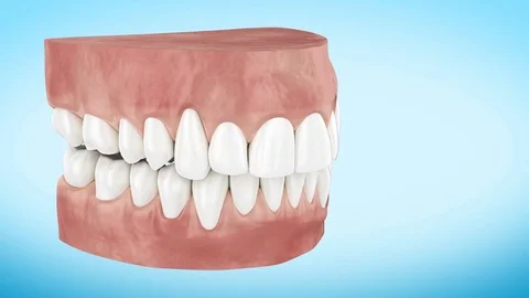 Beautiful White Clean Teeth Turning Stock-Footage 80233472